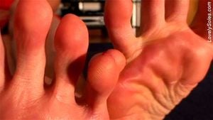 Soles thumbnail