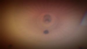 Watch from 0:00:33