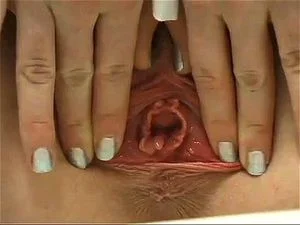 Prolapse and gape thumbnail