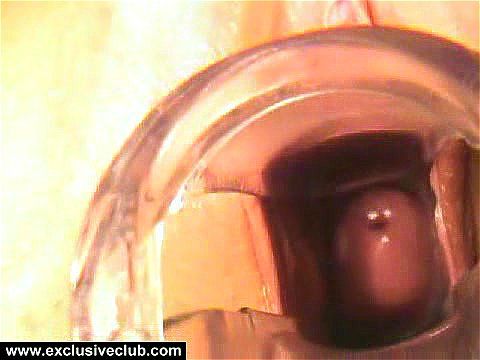 Watch Roza Gyno Exam - Gyno Exam, Gynecological Examination, Fetish Porn