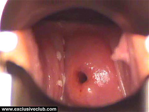 Dyan 2 Gyno Exam: Fetish, Vintage & Xnxx Porn - SpankBang